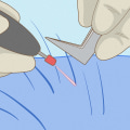 How to properly groom male pubic hair?