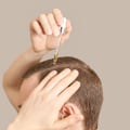 Male Grooming: How to Maintain a Healthy Scalp and Prevent Dandruff